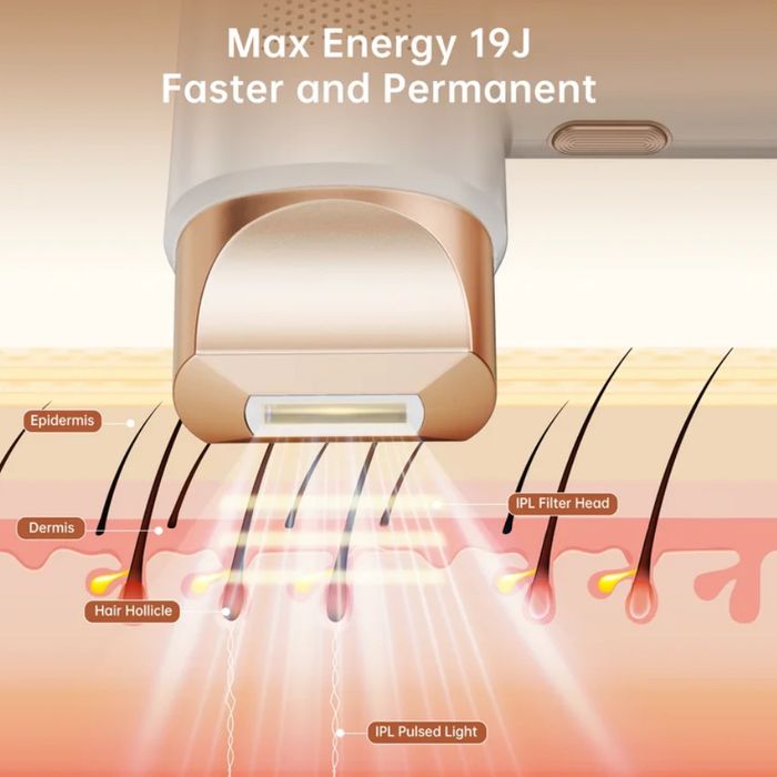 Продается Фотоэппилятор IPL FZ-608