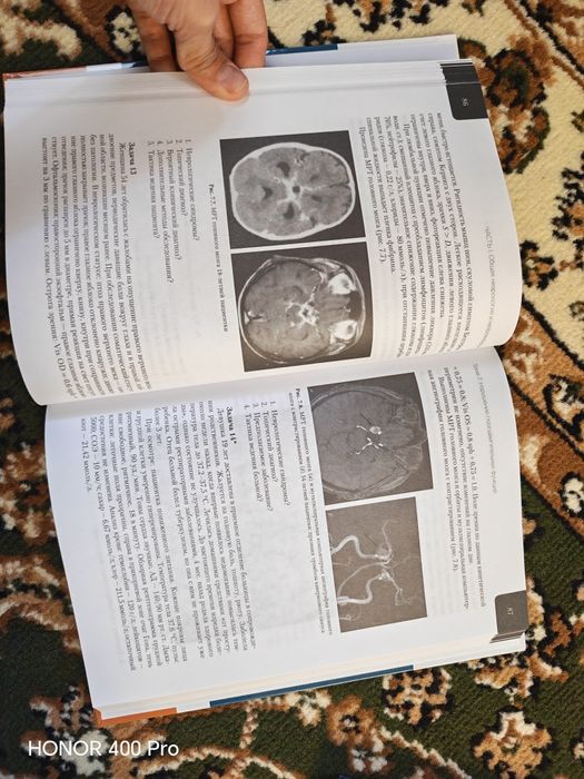 Книга по неврологии