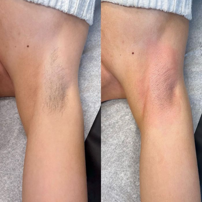 Обучение шугаринг