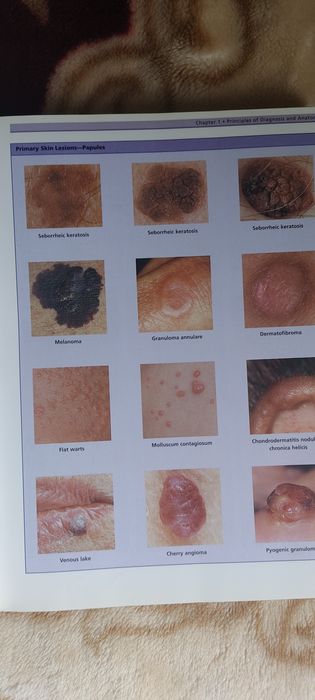 Carte Clinical Dermatology