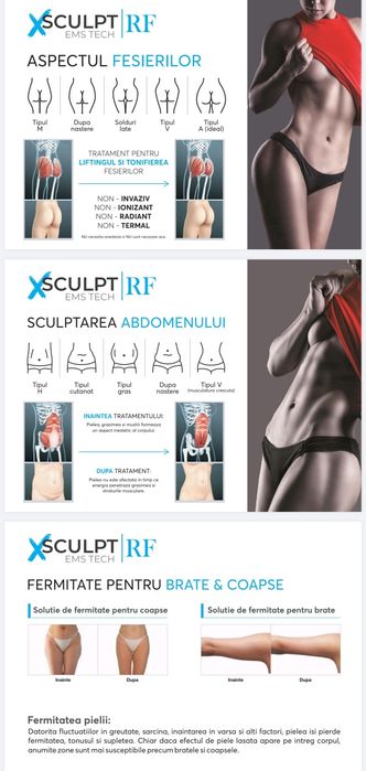 XSCULPT cu radiofrecvență, aparat pentru stimulare musculara