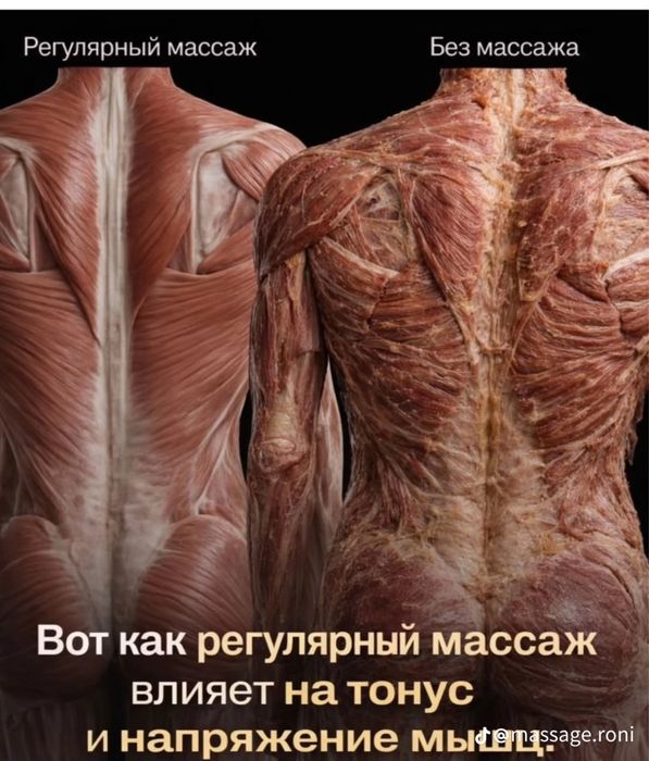 Акция на массаж 10.000