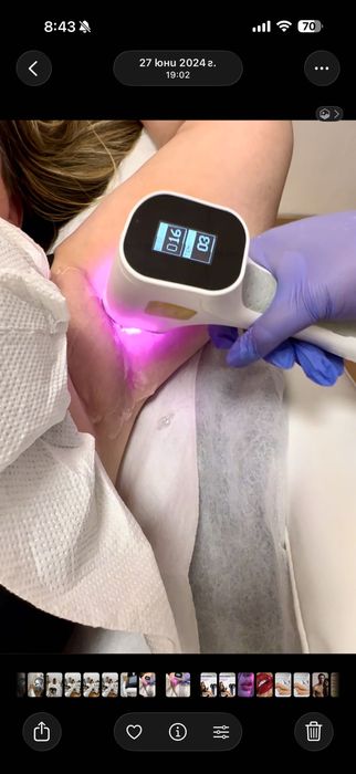 Професионален диоден лазер 755/808/1064 nm от Dermis( Отлично състояние)