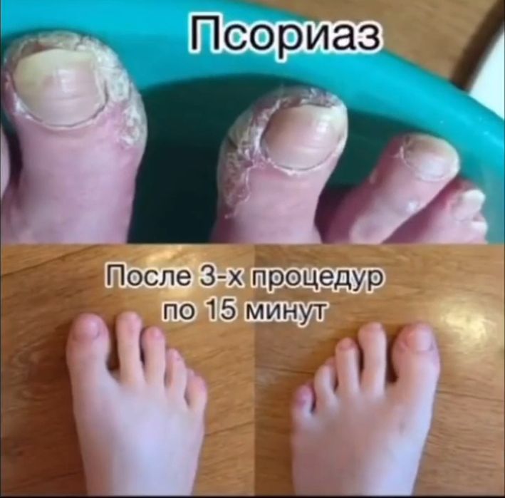 Продам аппарат Активатор клеток