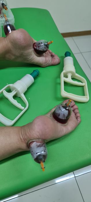 Хиджама клиникасы