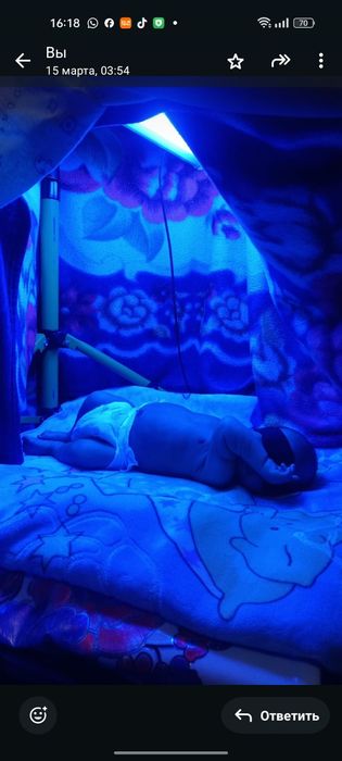 Фототерапия для новорожденных