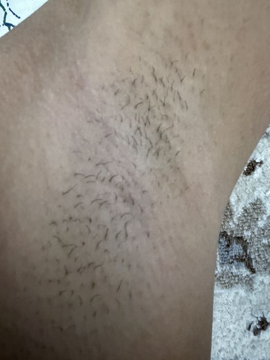 Шугаринг сахар~воск.