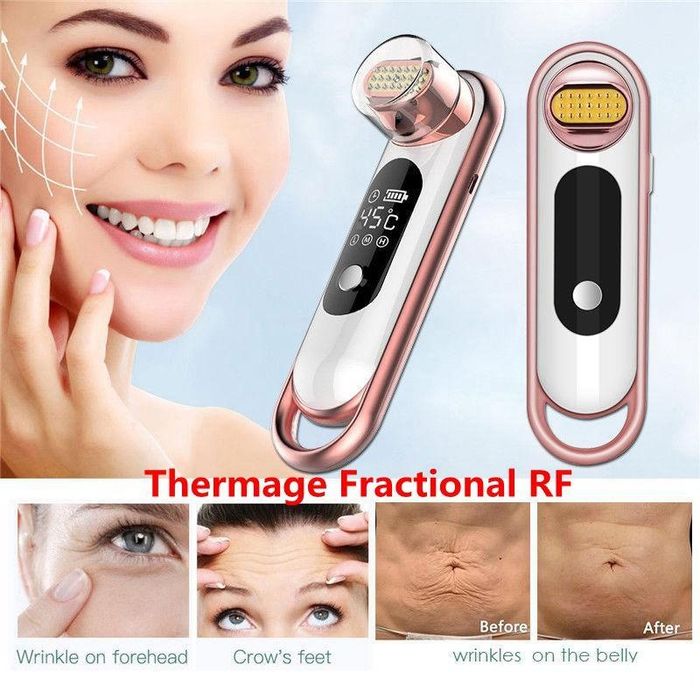 Портативен RF термаж радиочестотен лифтинг, Бръчки, увиснала кожа