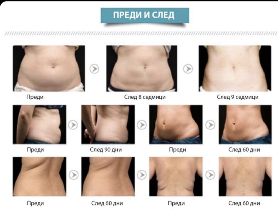 Апарат за кавитация, вакуум и радиочестотен лифтинг 5в1.