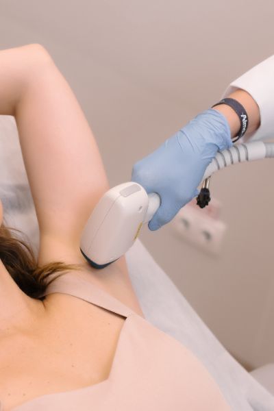 Лазерная эпиляция