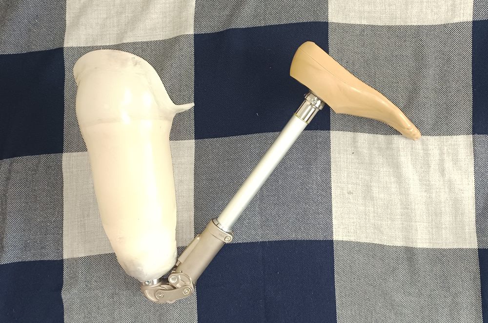 Протез бедра Сон протези