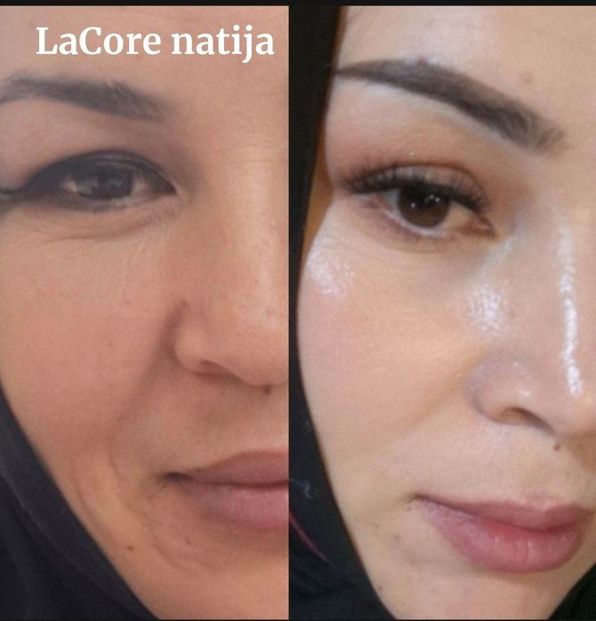 Sifati kafolatli yuz uxodlari ishonchli