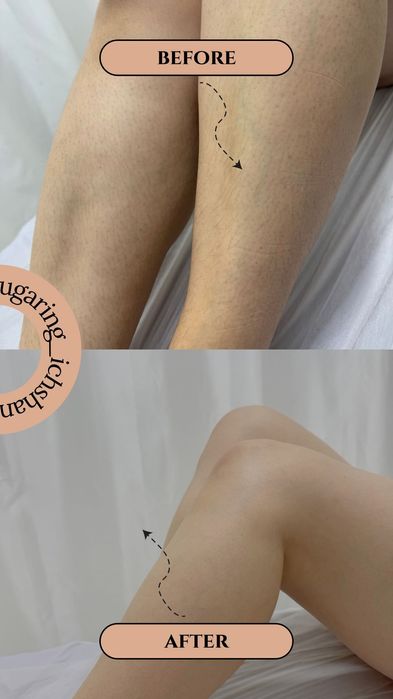 Шугаринг выезд на дом 1000 тг