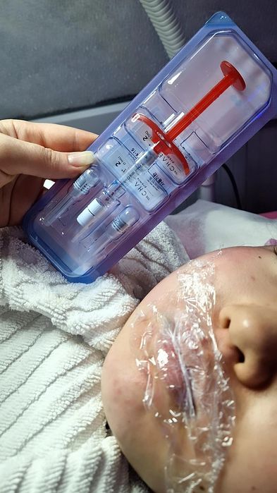 Увеличение губ Косметолог