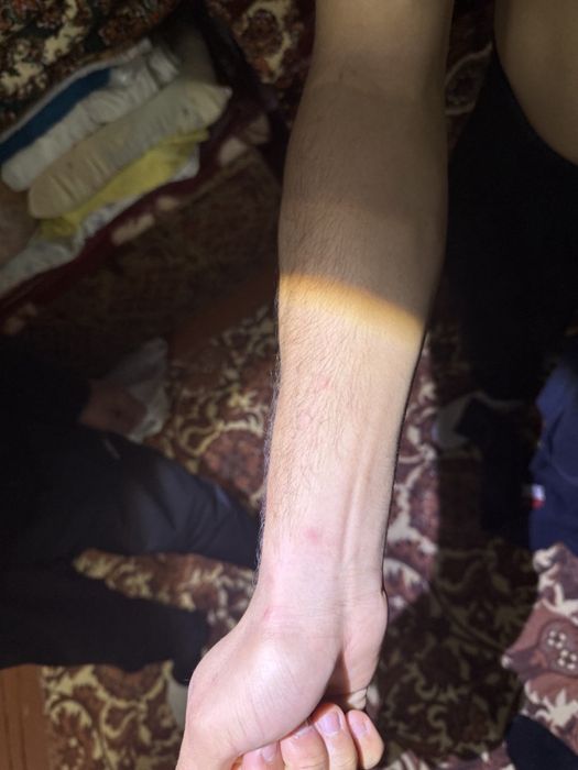 Dezinfeksiya dezinseksiya deratizatsiya xizmati 24/7