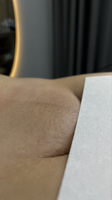 Обучаю депиляции