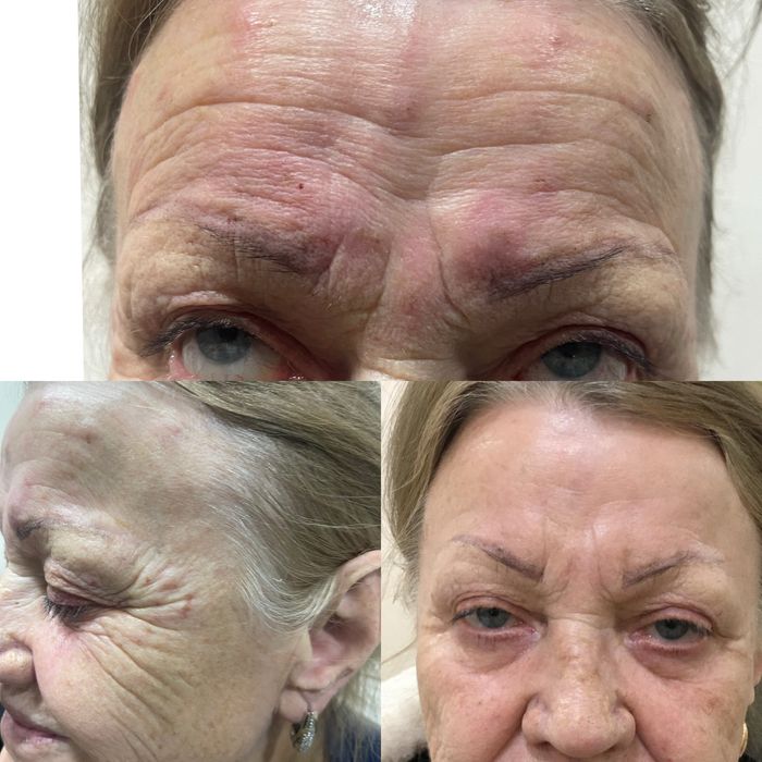 Косметолог на дому