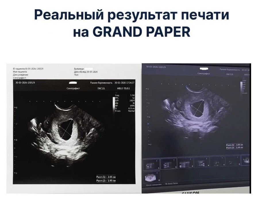 Фотобумага для узи принтеров