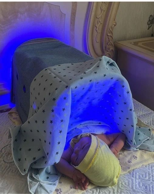 Фотолампа от желтухи