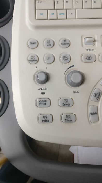 Ехограф Sono Scape S11