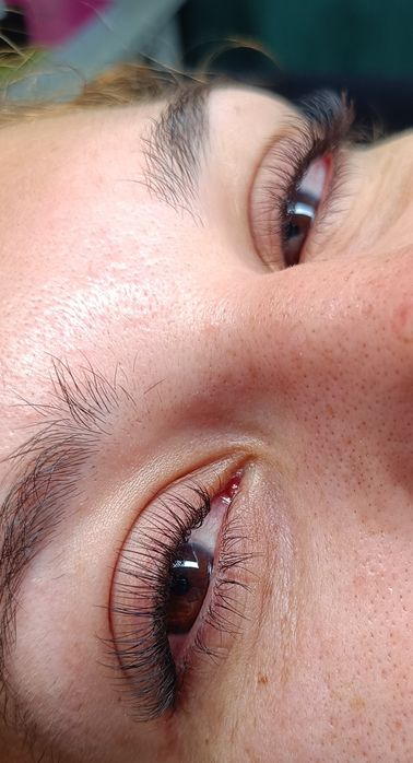 Gene fir cu fir tehnica one by one