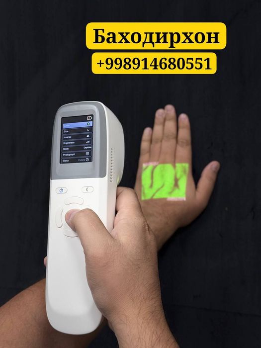 Веновизор оргинал оптом нархда