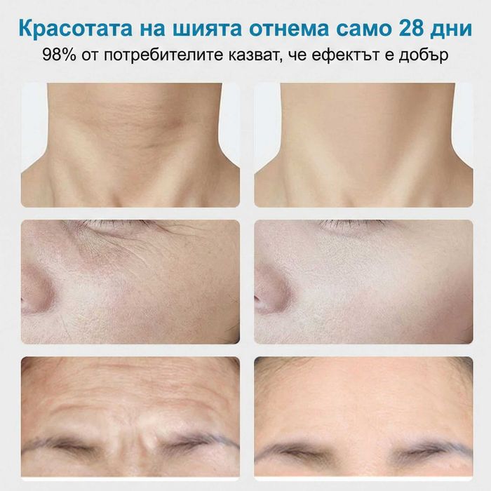 Уред за лифтинг на лице STELS Q32, RF, EMS, LED, безиглена мезотерапия