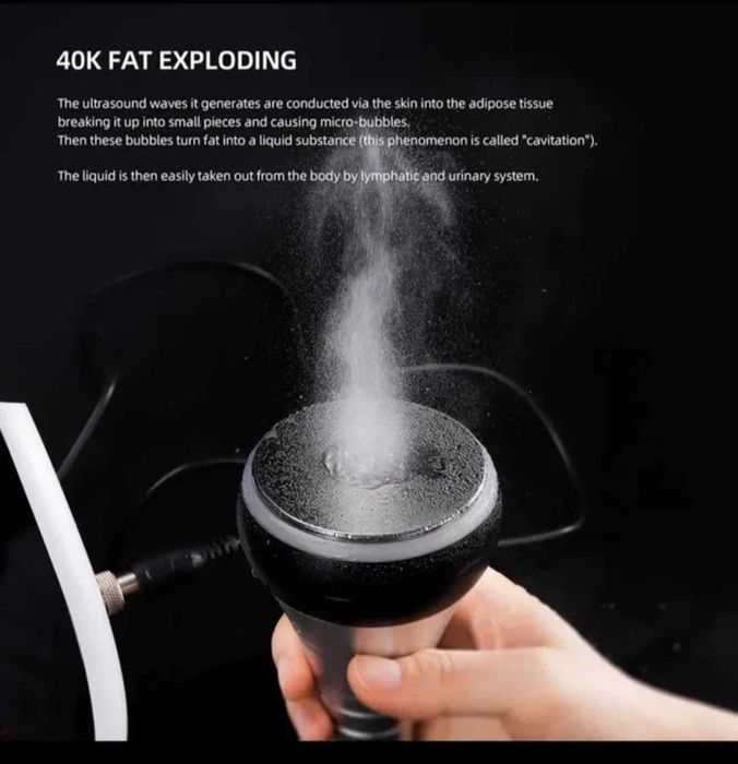 RF радиочестотен лифтинг и 40К кавитация