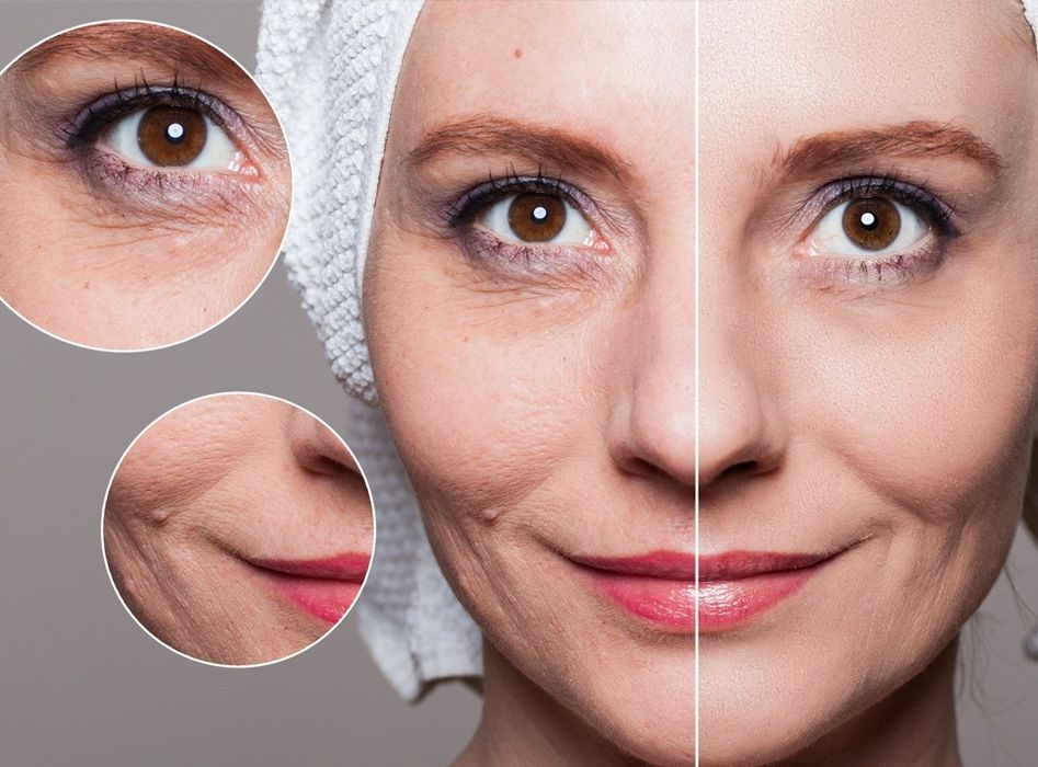 Ботокс,Губы в Ташкенте