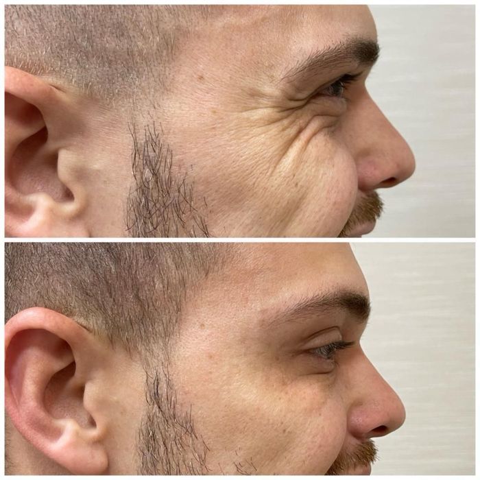 Косметолгия Мужинь и женшинь