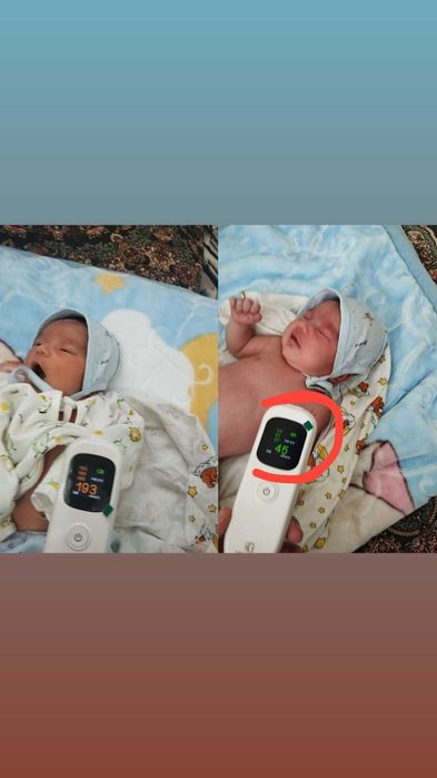 Bilitest билитест билирубиновый анализатор жетлушка фотолампа fotolamp