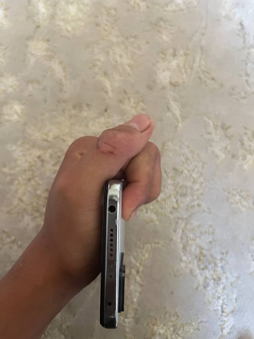 Redmi note 11 pro