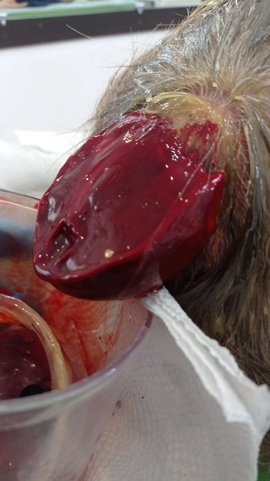 хиджама, массаж, диагностика, иглотерапия