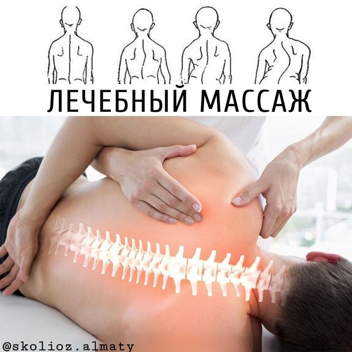 Лечение  сколиоз, грыжи позвоночника, протрузии, остеохондроза.