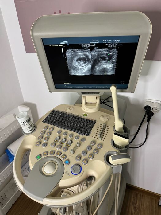 УЗИ аппарат Medison SonoAce X6
