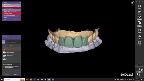 Exocad CAD/CAM | Zirkoniya va PMMA 3D modellar