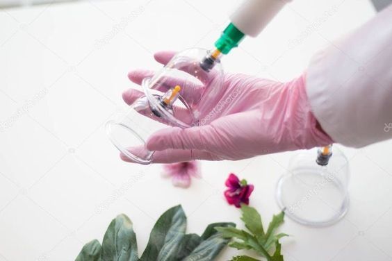 Xijoma va zukuk va hijoma хиджама