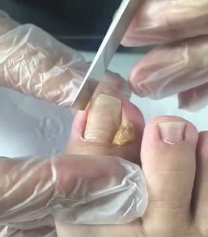 Pedichiura profesională Comănești / Bacău