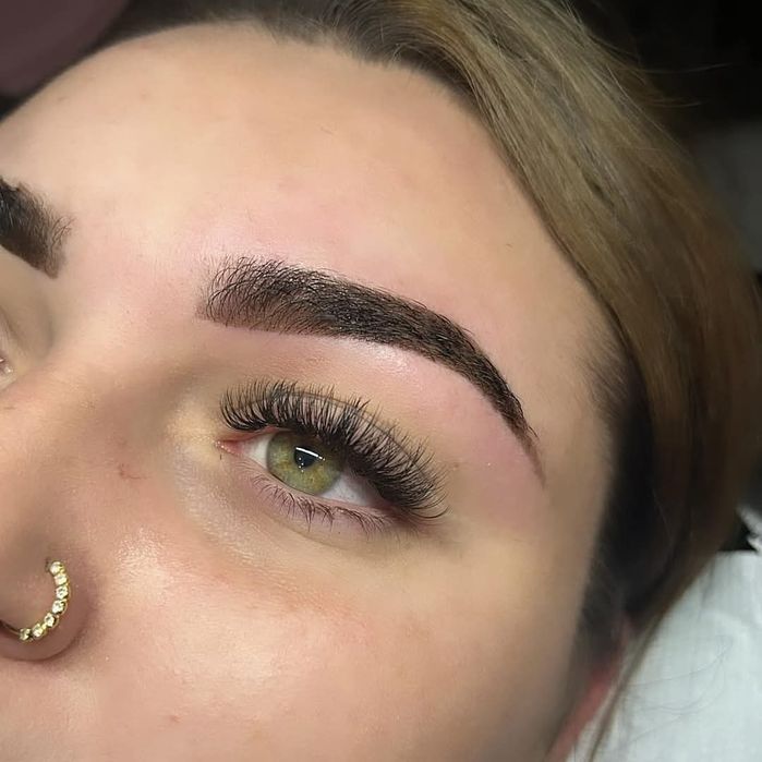 Extensii de gene 1-5D