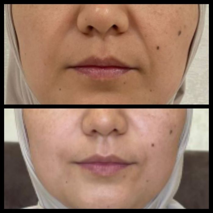 Массаж лица Караганда Юго-Восток