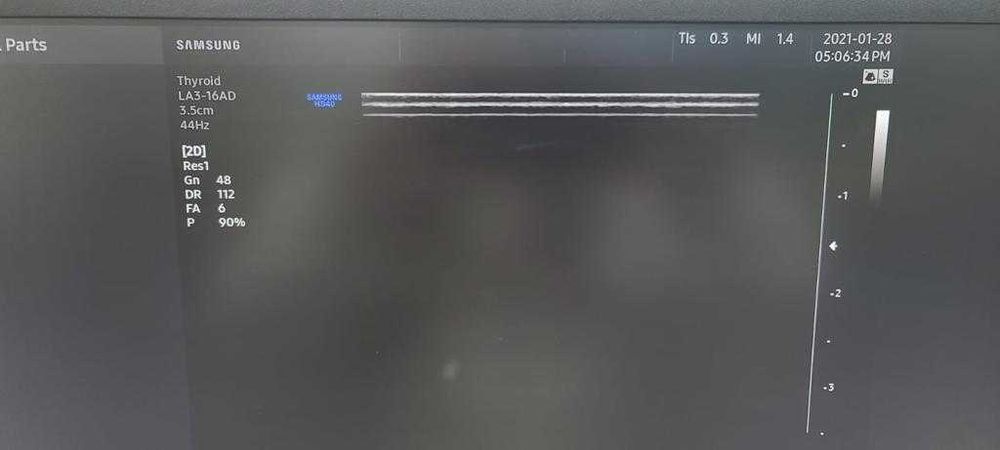 УЗИ сканер H60 (Samsung Medison)