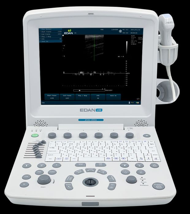 Продается аппарат УЗИ ЭДАН-60