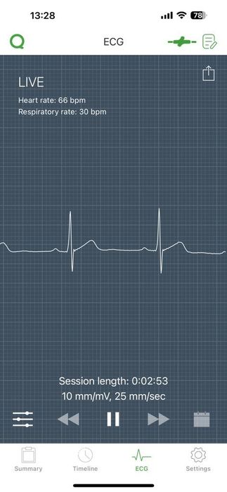 Qardio Core monitorizare cardio