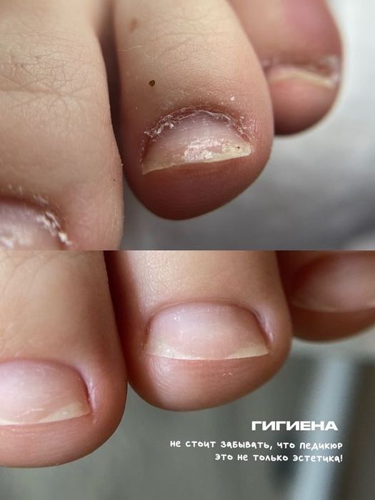 Педикюр Мужской и Женский