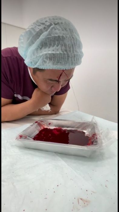 Шертпе со лба хиджама