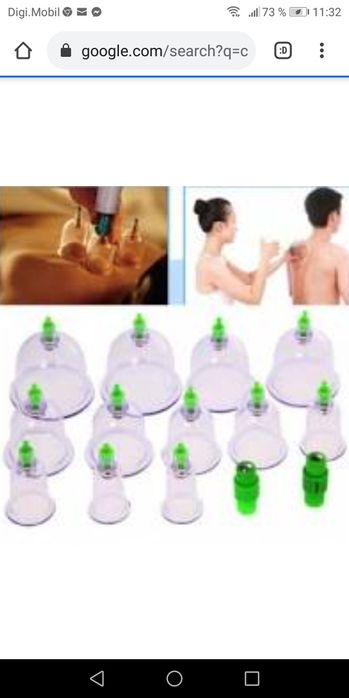 Terapie cu ventuze. Cupping terapie.