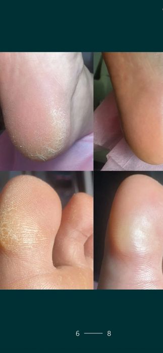 Мужской педикюр и маникюр