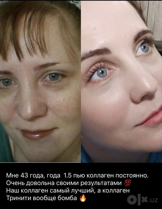 Коллаген тринити- для здоровья и красоты кожи, волос, ногтей, суставов
