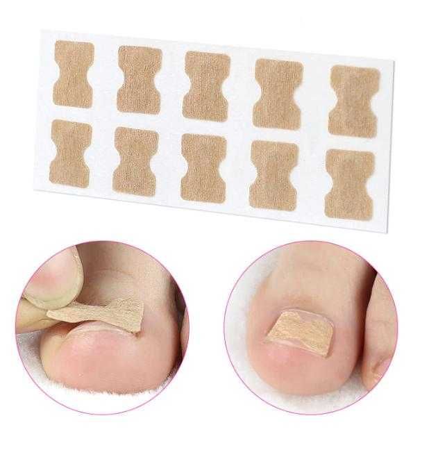 10 самозалепващи се стикери за нокти, без нужда от лепило. Лесни за поставяне и премахване. Декорация на Нокти Врастнали Нокти на Краката ПАРОНИХИЯ