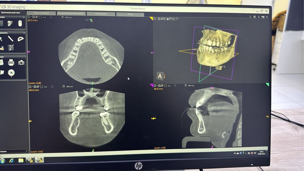 3D рентген апаррат